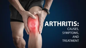 Arthritis