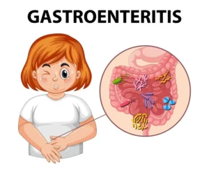 GASTROENTERITIS